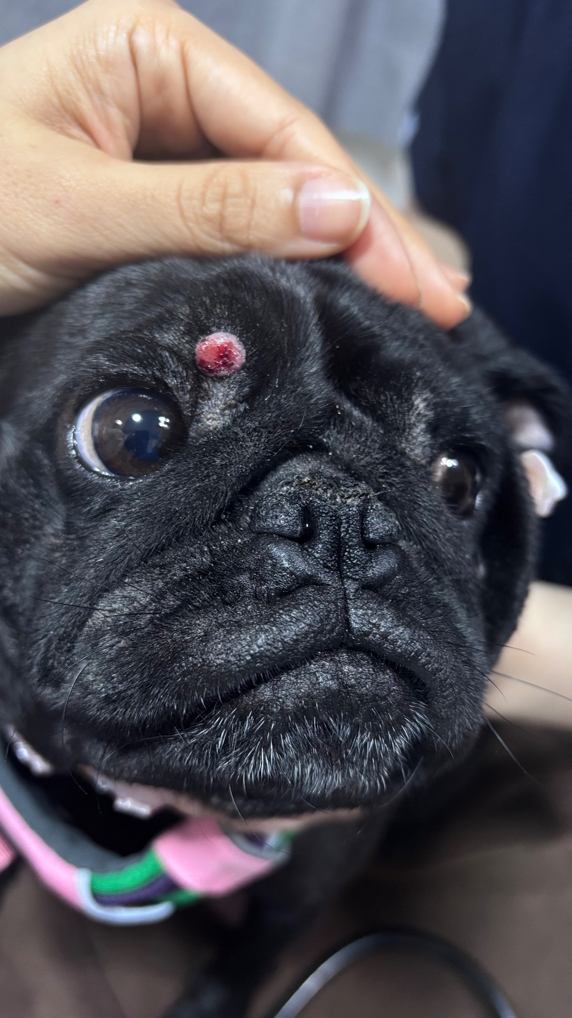 Minis: Complete Tumor Remission Through Chemotherapy - 治療前