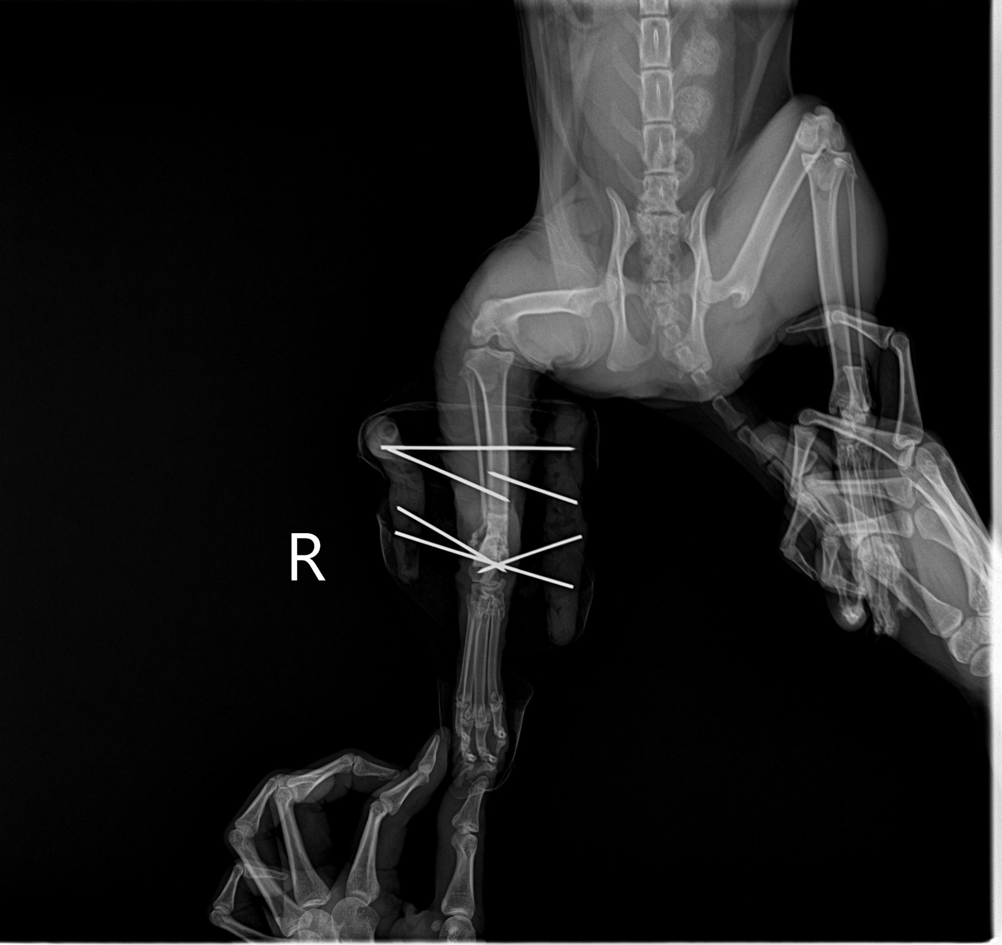 Sock's Recovery: Right Tibia & Fibula Fracture Repair - 治療後
